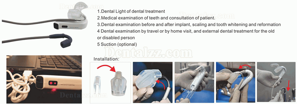 YUSENDENT®MaxBiteDB-138歯科コードレス口腔内用照明装置